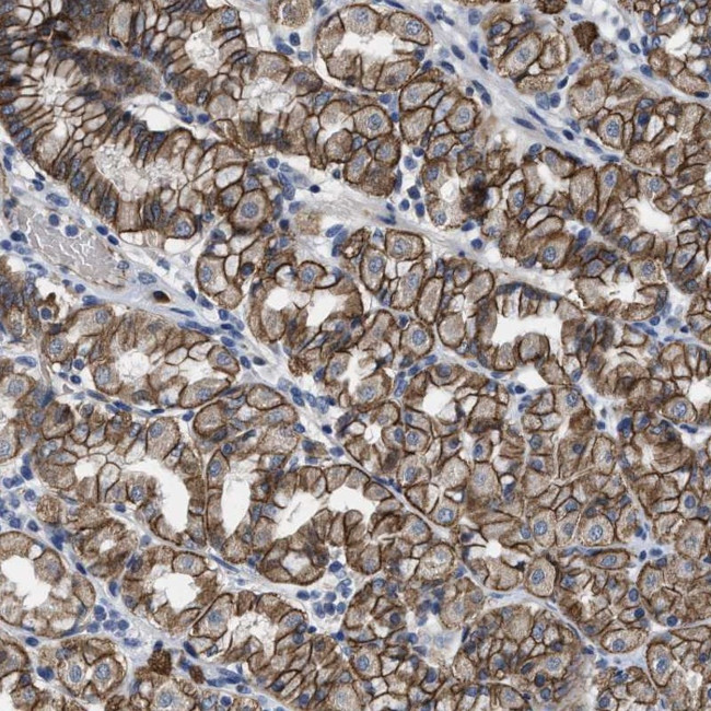 MICS1 Antibody in Immunohistochemistry (Paraffin) (IHC (P))