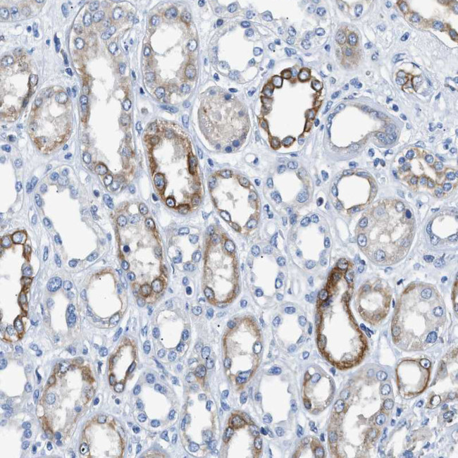 TAUT Antibody in Immunohistochemistry (Paraffin) (IHC (P))