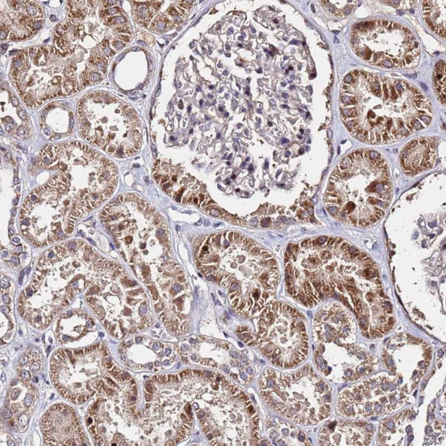 WNK4 Antibody in Immunohistochemistry (Paraffin) (IHC (P))