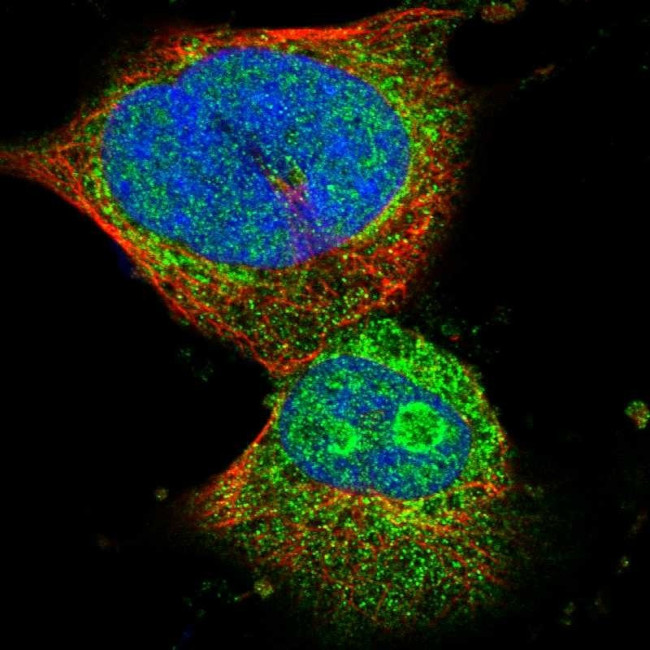 SMIM20 Antibody in Immunocytochemistry (ICC/IF)