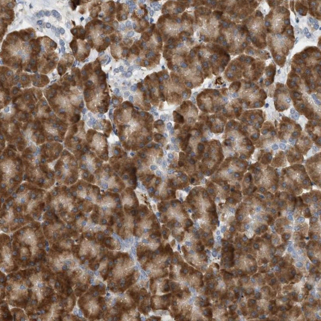 SVOP Antibody in Immunohistochemistry (Paraffin) (IHC (P))