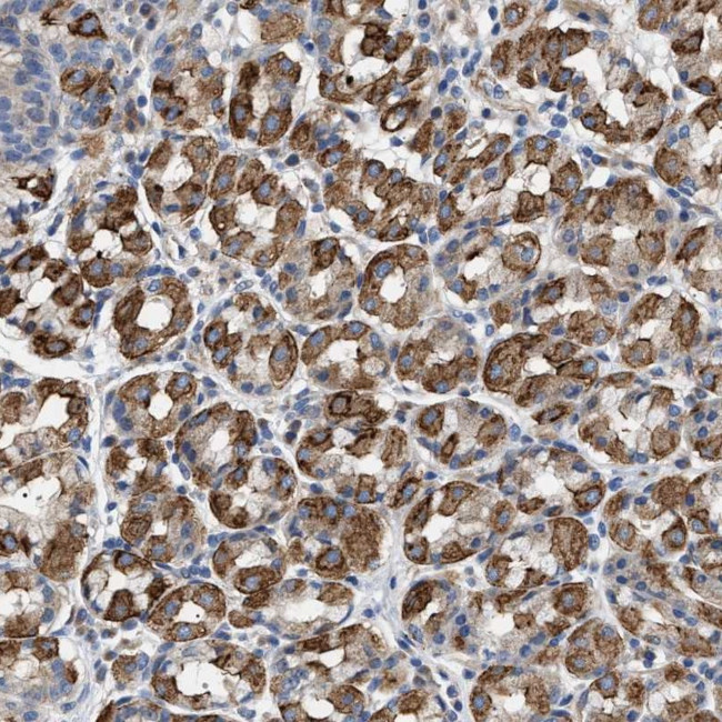 TMEM222 Antibody in Immunohistochemistry (Paraffin) (IHC (P))