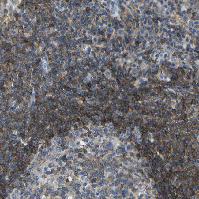 RCSD1 Antibody in Immunohistochemistry (Paraffin) (IHC (P))