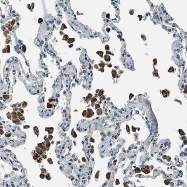 SLC19A2 Antibody in Immunohistochemistry (Paraffin) (IHC (P))
