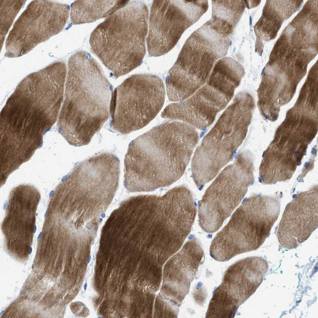 Nebulin Antibody in Immunohistochemistry (Paraffin) (IHC (P))