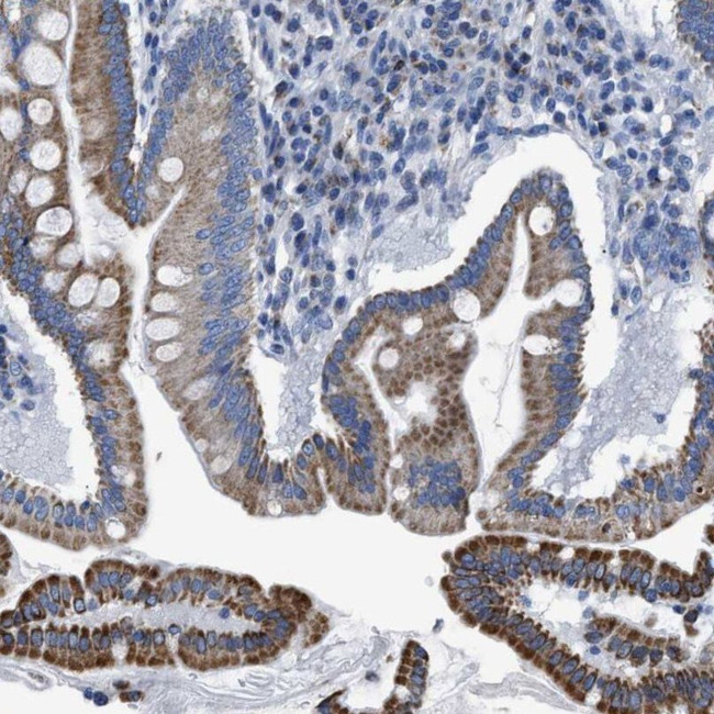 ZDHC3 Antibody in Immunohistochemistry (IHC)