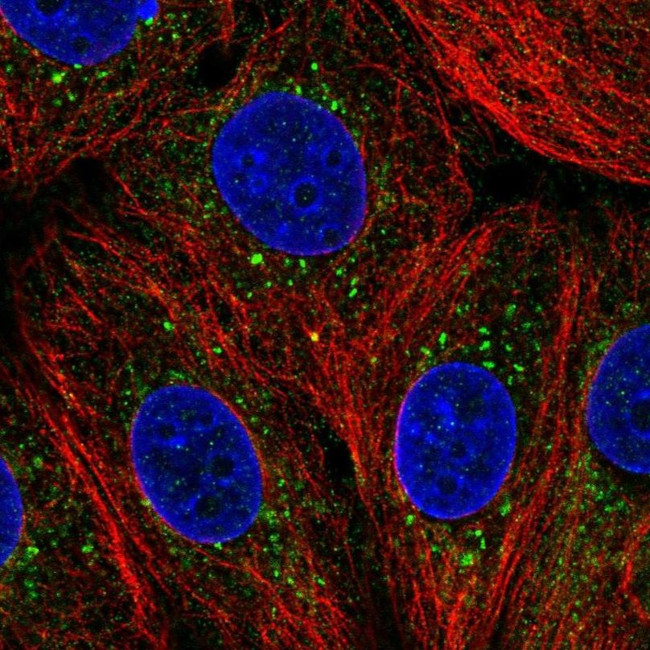 ZDHHC24 Antibody in Immunocytochemistry (ICC/IF)