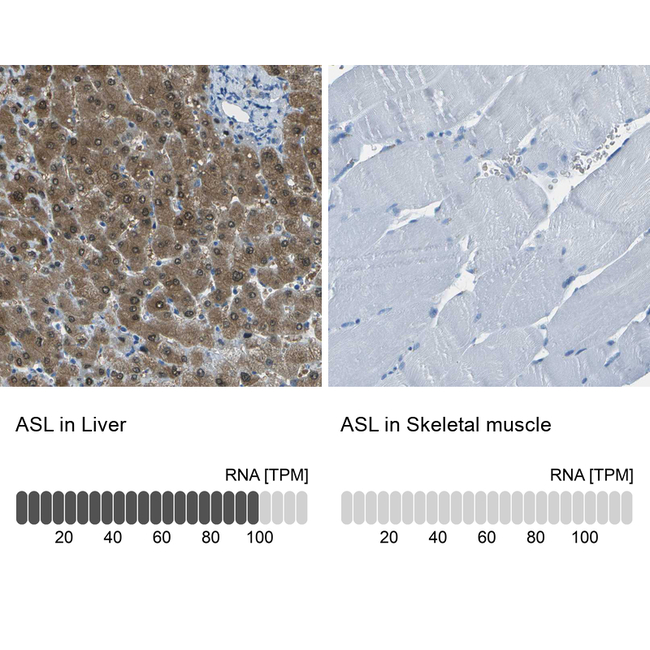 ASL Antibody in Immunohistochemistry (Paraffin) (IHC (P))