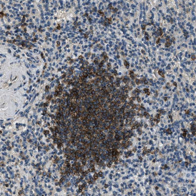 SALL3 Antibody in Immunohistochemistry (Paraffin) (IHC (P))