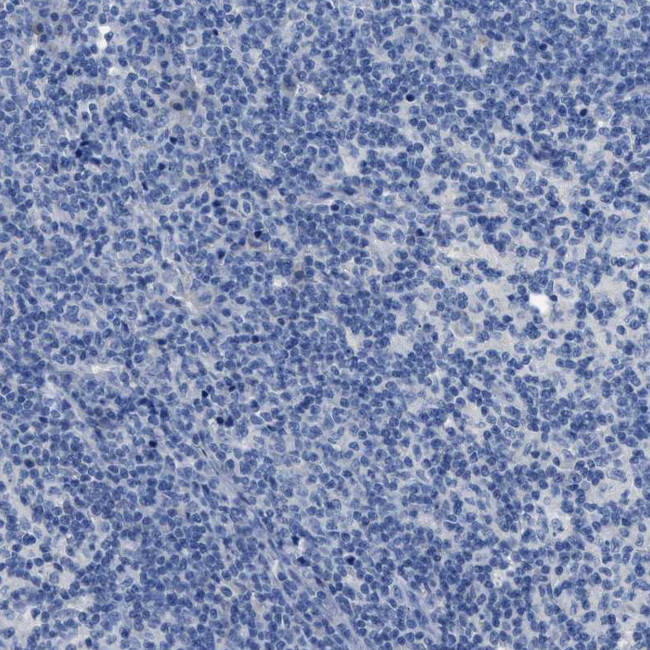 SLC10A6 Antibody in Immunohistochemistry (Paraffin) (IHC (P))
