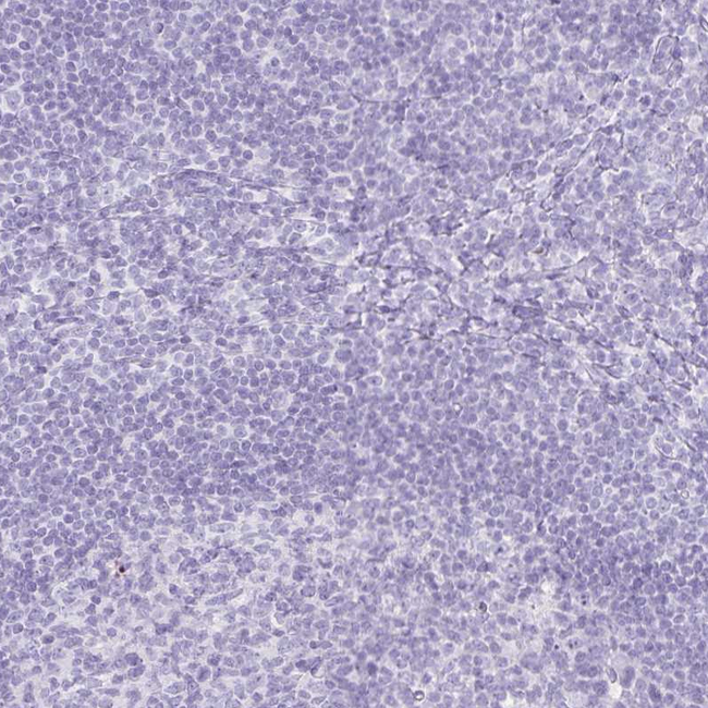 GP2 Antibody in Immunohistochemistry (Paraffin) (IHC (P))