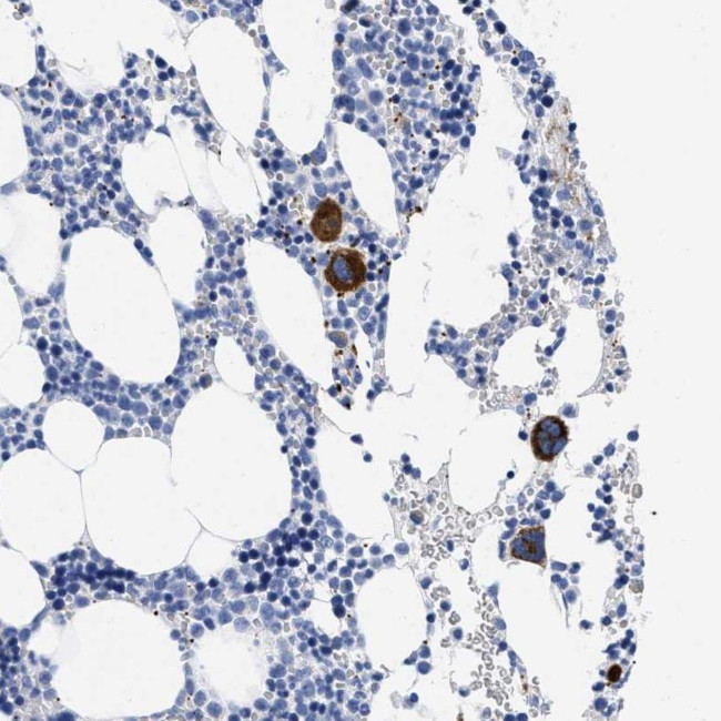 TREML1 Antibody in Immunohistochemistry (Paraffin) (IHC (P))