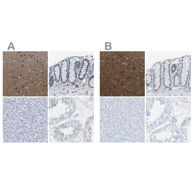 MAPRE2 Antibody in Immunohistochemistry (IHC)