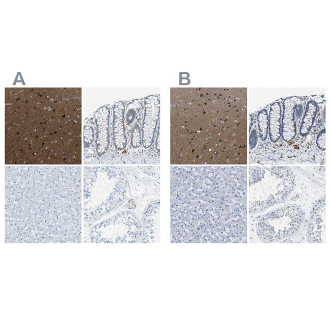 MAPRE2 Antibody in Immunohistochemistry (IHC)