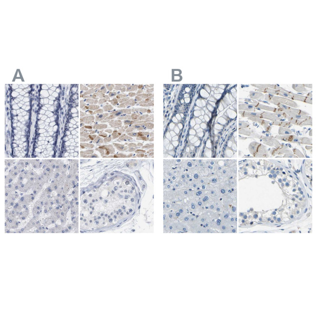 XIRP1 Antibody in Immunohistochemistry (IHC)