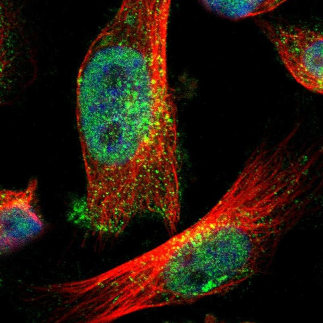 ZFAND3 Antibody in Immunocytochemistry (ICC/IF)