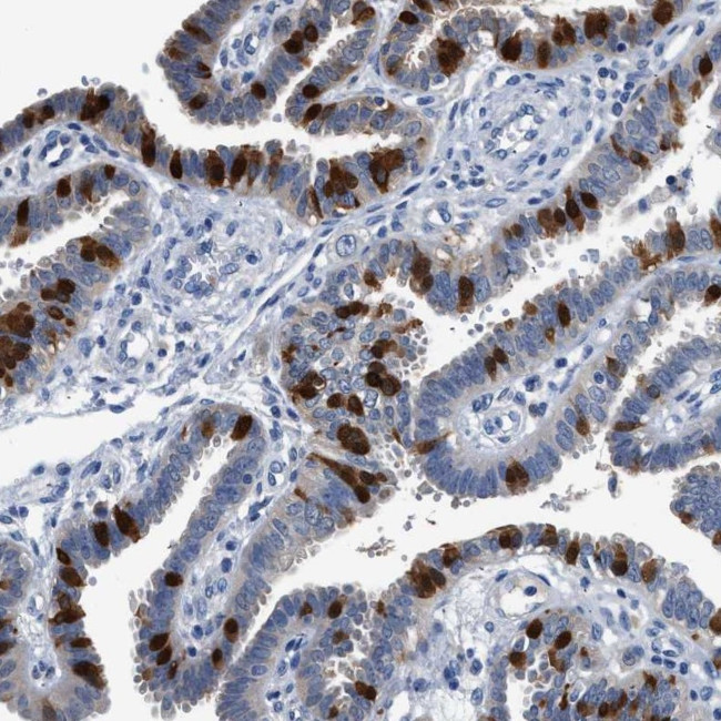 FADS6 Antibody in Immunohistochemistry (Paraffin) (IHC (P))