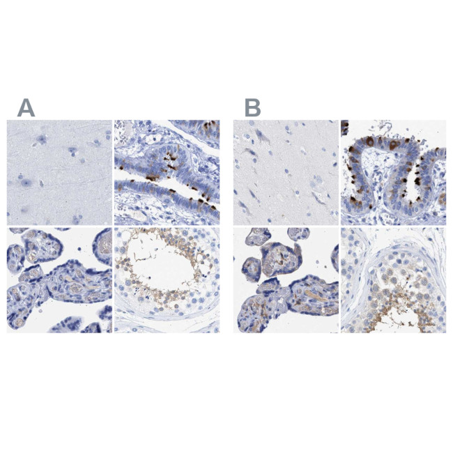 TSGA2 Antibody in Immunohistochemistry (IHC)