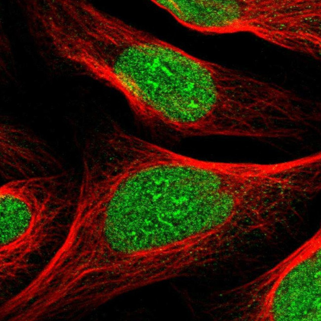 ZNF297B Antibody in Immunocytochemistry (ICC/IF)