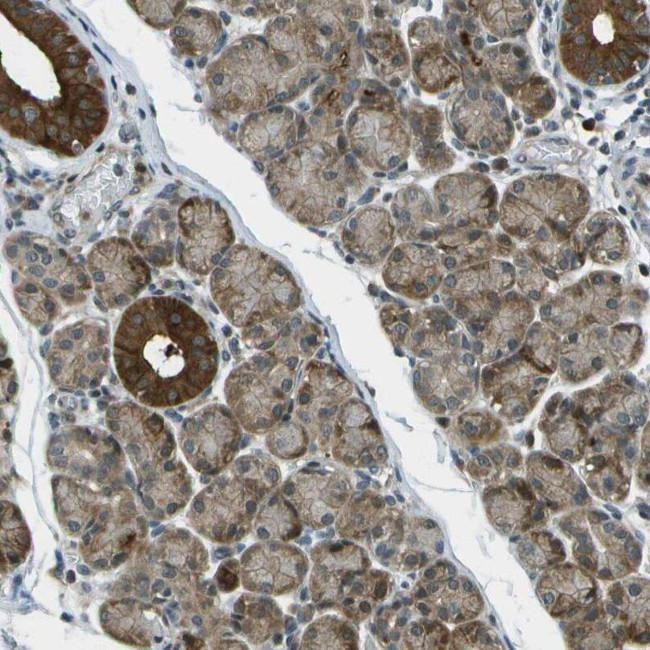 TMEM19 Antibody in Immunohistochemistry (IHC)