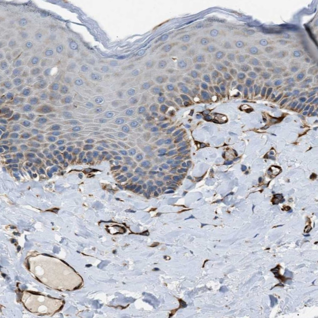 ZNF831 Antibody in Immunohistochemistry (Paraffin) (IHC (P))