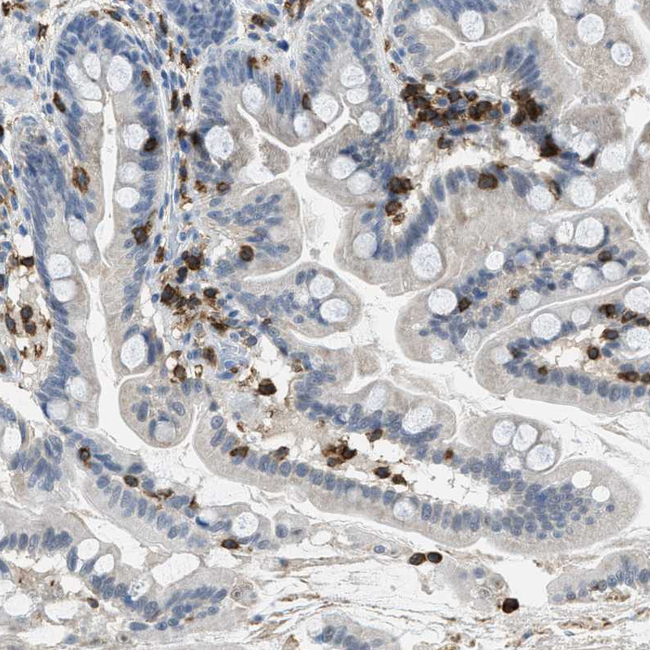 FAM151A Antibody in Immunohistochemistry (Paraffin) (IHC (P))