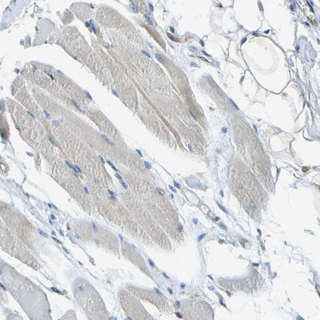 FAM62A Antibody in Immunohistochemistry (Paraffin) (IHC (P))
