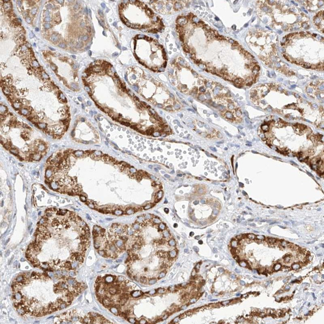TTLL8 Antibody in Immunohistochemistry (Paraffin) (IHC (P))