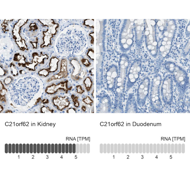 C21orf62 Antibody in Immunohistochemistry (IHC)