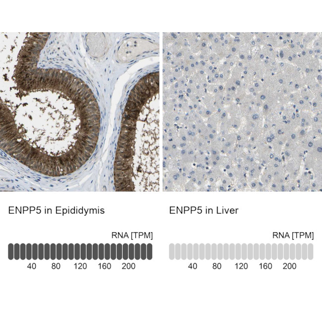 ENPP5 Antibody in Immunohistochemistry (IHC)