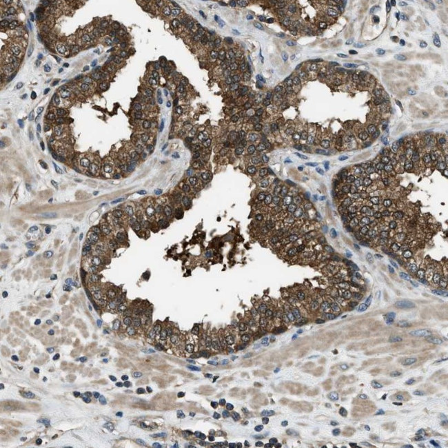 HEBP2 Antibody in Immunohistochemistry (Paraffin) (IHC (P))