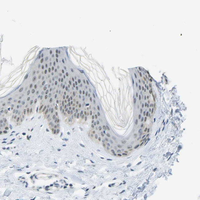 PITHD1 Antibody in Immunohistochemistry (IHC)