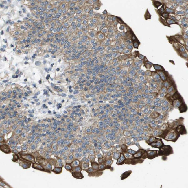 Cytokeratin 23 Antibody in Immunohistochemistry (Paraffin) (IHC (P))