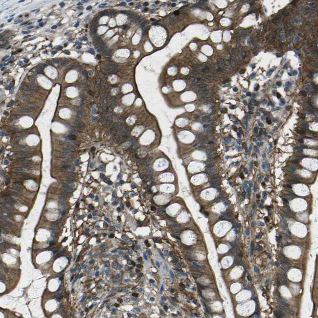 PDLIM1 Antibody in Immunohistochemistry (Paraffin) (IHC (P))