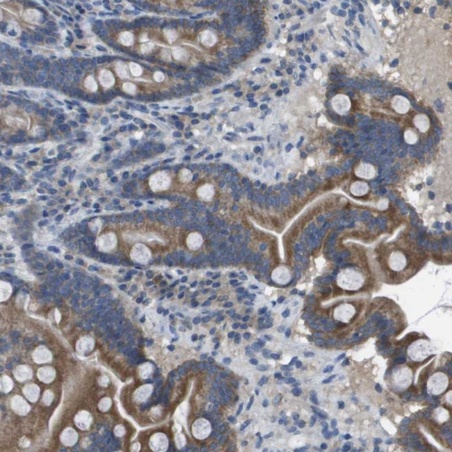 CLCA4 Antibody in Immunohistochemistry (Paraffin) (IHC (P))