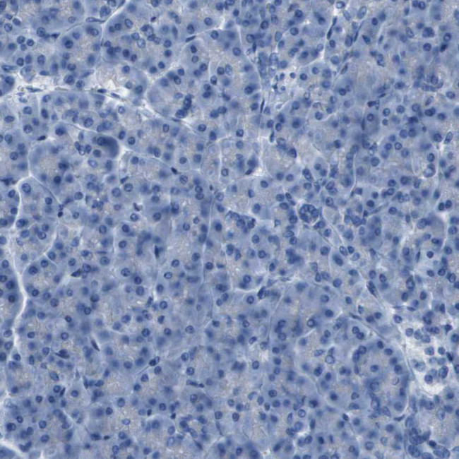 CDHR2 Antibody in Immunohistochemistry (Paraffin) (IHC (P))