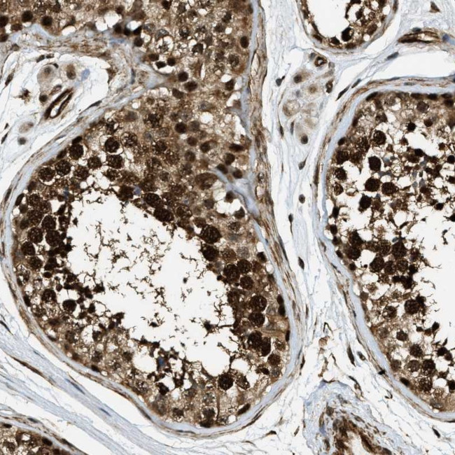 CCDC104 Antibody in Immunohistochemistry (Paraffin) (IHC (P))