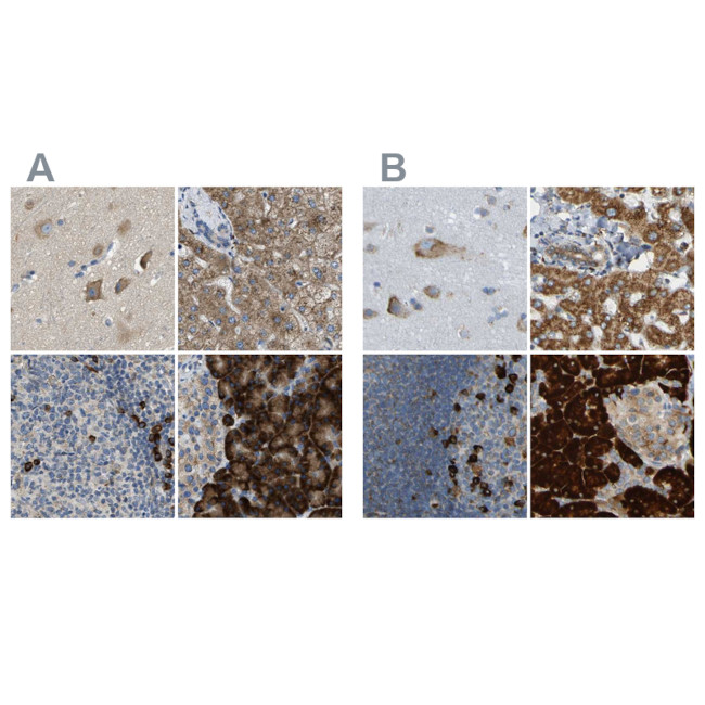 TRAP alpha Antibody in Immunohistochemistry (IHC)