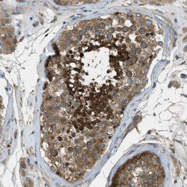Vezatin Antibody in Immunohistochemistry (Paraffin) (IHC (P))