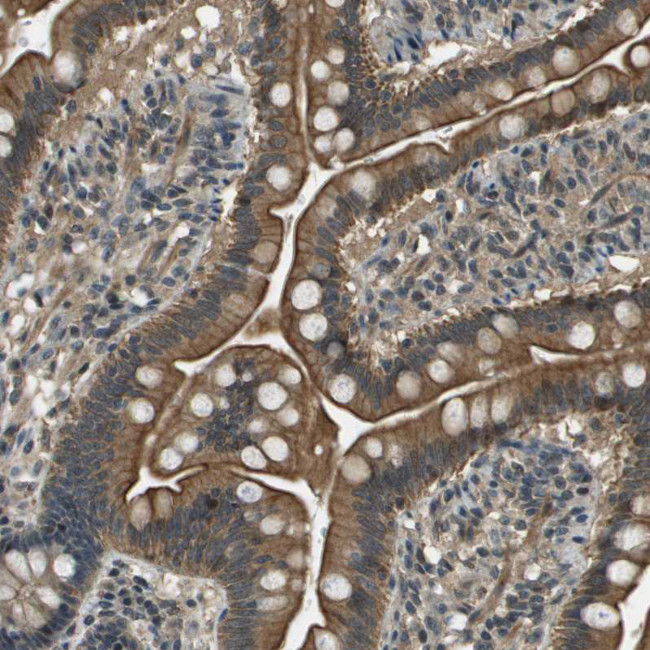 Syndecan 3 Antibody in Immunohistochemistry (Paraffin) (IHC (P))