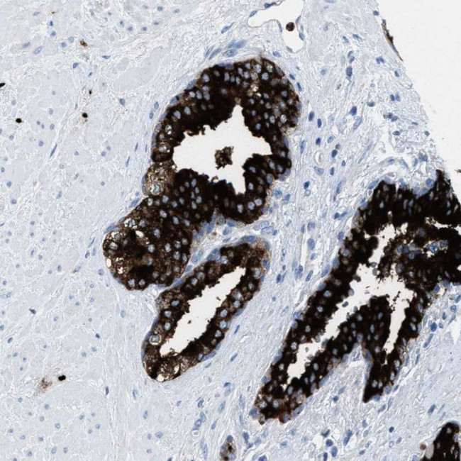 CMTM1 Antibody in Immunohistochemistry (Paraffin) (IHC (P))