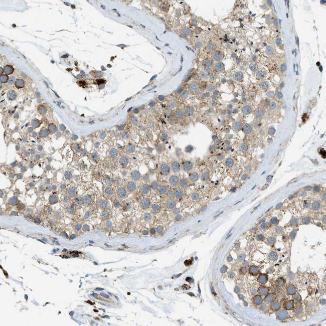 PLBD2 Antibody in Immunohistochemistry (Paraffin) (IHC (P))