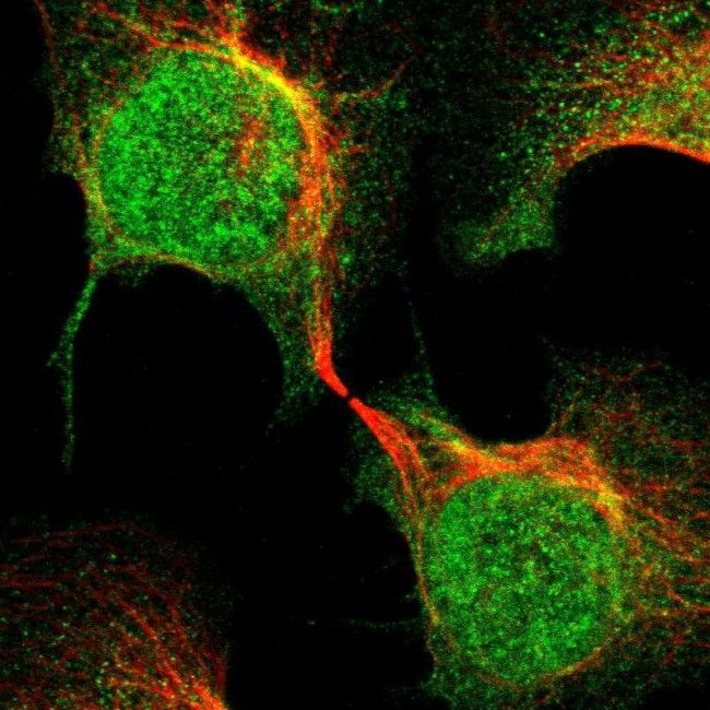 MED21 Antibody in Immunocytochemistry (ICC/IF)