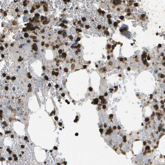 CACHD1 Antibody in Immunohistochemistry (Paraffin) (IHC (P))