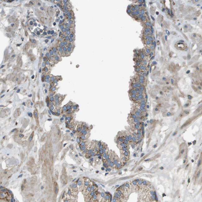 NRK Antibody in Immunohistochemistry (Paraffin) (IHC (P))