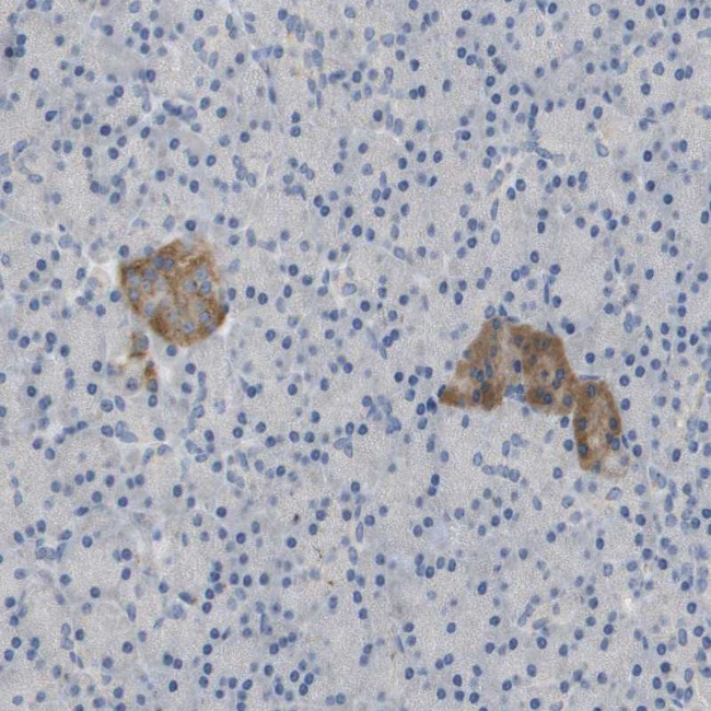 FNDC9 Antibody in Immunohistochemistry (Paraffin) (IHC (P))