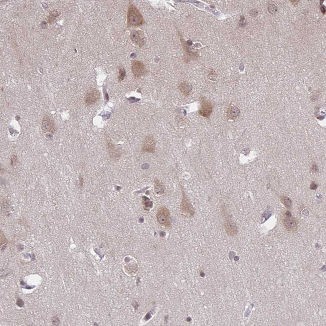 ARPP21 Antibody in Immunohistochemistry (Paraffin) (IHC (P))