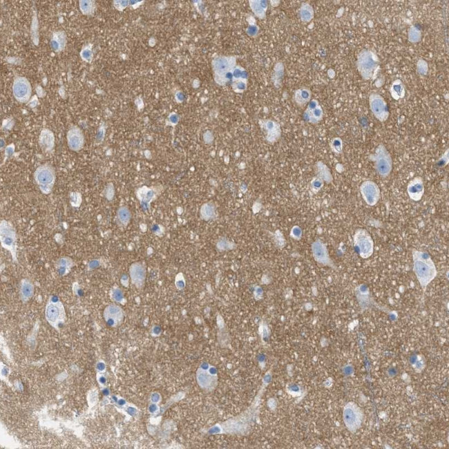 GPM6A Antibody in Immunohistochemistry (IHC)