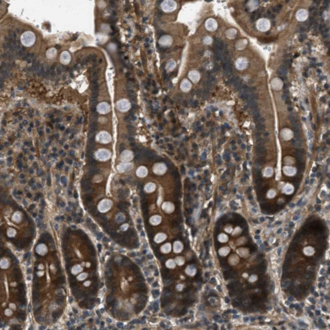 EPSTI1 Antibody in Immunohistochemistry (Paraffin) (IHC (P))