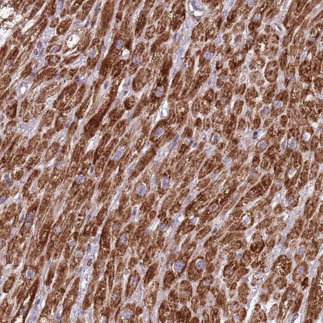 IRS4 Antibody in Immunohistochemistry (Paraffin) (IHC (P))